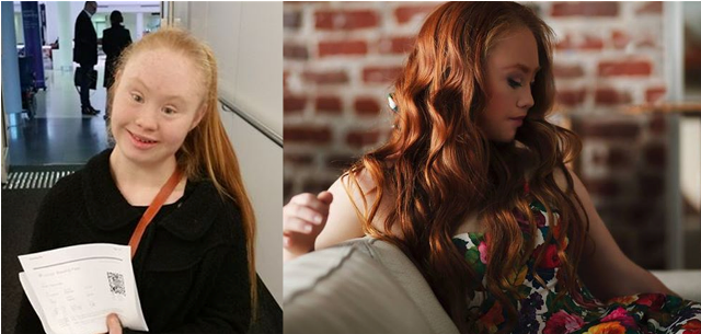 Madeline Stuart - modelka z zespołem Downa Miss D
