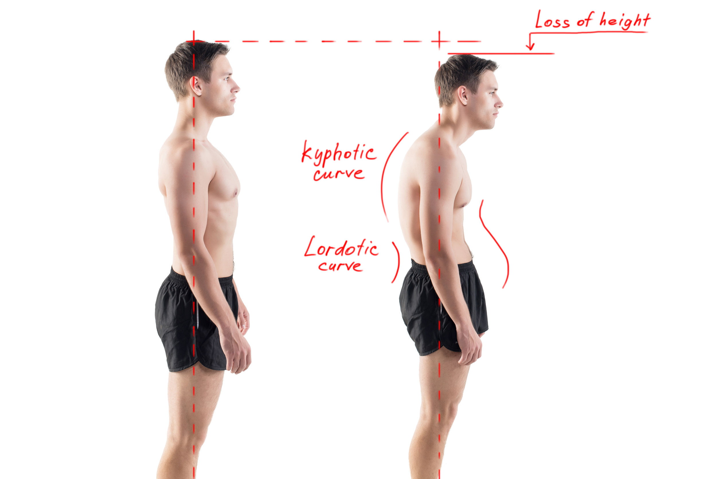 importance of good posture